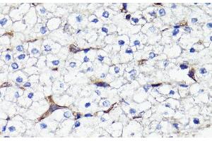 Immunohistochemistry of paraffin-embedded Human liver using CD44 Polyclonal Antibody at dilution of 1:100 (40x lens). (CD44 Antikörper)