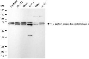 Western blotting analysis using G protein-coupled receptor kinase 6 antibody (ABIN7798675).
