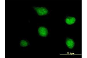 Immunofluorescence of purified MaxPab antibody to ZNF278 on HeLa cell. (PATZ1 Antikörper  (AA 1-537))