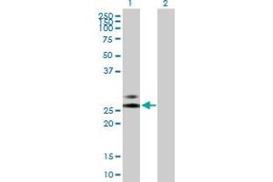Western Blot analysis of RNASE2 expression in transfected 293T cell line by RNASE2 MaxPab polyclonal antibody. (RNASE2 Antikörper  (AA 1-161))