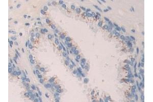 Detection of CNTN4 in Human Prostate Tissue using Polyclonal Antibody to Contactin 4 (CNTN4) (Contactin 4 Antikörper  (AA 731-980))