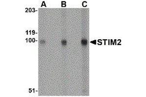 Western Blotting (WB) image for anti-Stromal Interaction Molecule 2 (Stim2) (Center) antibody (ABIN2476610)