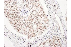 anti-Ubiquitin-Like 7 (Bone Marrow Stromal Cell-Derived) (UBL7) (AA 330-380) antibody