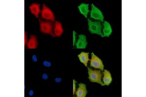 ABIN6265763 and ABIN6278539 staining  cells by IF/ICC.