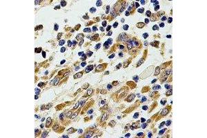 Immunohistochemical analysis of Chitotriosidase staining in human stomach formalin fixed paraffin embedded tissue section. (Chitotriosidase 1 Antikörper)