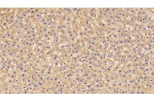 Detection of PALB in Rat Liver Tissue using Polyclonal Antibody to Prealbumin (PALB) (TTR Antikörper  (AA 20-147))