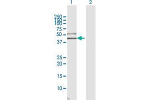 Western Blotting (WB) image for anti-Single Immunoglobulin and Toll-Interleukin 1 Receptor (TIR) Domain (SIGIRR) (AA 1-410) antibody (ABIN528391)
