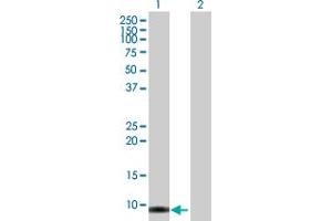 Western Blot analysis of SMR3B expression in transfected 293T cell line by SMR3B MaxPab polyclonal antibody.