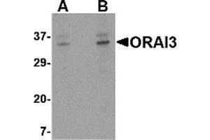 Western Blotting (WB) image for anti-ORAI Calcium Release-Activated Calcium Modulator 3 (ORAI3) (C-Term) antibody (ABIN1030564) (ORAI3 Antikörper  (C-Term))