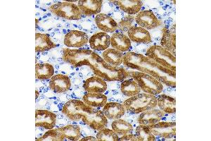 Immunohistochemistry of paraffin-embedded mouse kidney using NQO1 antibody (ABIN7268795) at dilution of 1:100 (40x lens). (NQO1 Antikörper)