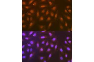 Immunofluorescence analysis of U-2 OS cells using Syntenin Rabbit mAb (ABIN7270680) at dilution of 1:100 (40x lens). (SDCBP Antikörper)