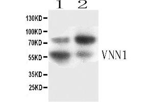 Western blot analysis of VNN1 expression in SKOV3 whole cell lysates ( Lane 3) and HELA whole cell lysates ( Lane 4). (VNN1 Antikörper  (AA 22-192))