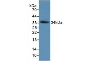 Detection of Recombinant COL7, Human using Monoclonal Antibody to Collagen Type VII (COL7) (COL7 Antikörper  (AA 190-472))