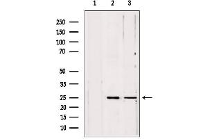 Western blot analysis of extracts from various samples, using PLDN antibody. (Pallidin Antikörper  (C-Term))