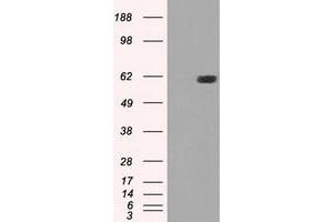 HEK293T cells were transfected with the pCMV6-ENTRY control (Left lane) or pCMV6-ENTRY STK39 (Right lane) cDNA for 48 hrs and lysed. (STK39 Antikörper)
