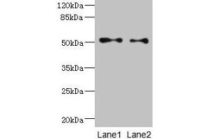 Western blot All lanes: TUBB3 antibody at 6 μg/mL Lane 1: A549 whole cell lysate Lane 2: A431 whole cell lysate Secondary Goat polyclonal to rabbit IgG at 1/10000 dilution Predicted band size: 51, 43 kDa Observed band size: 51 kDa (TUBB3 Antikörper  (AA 1-210))