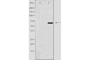 Western blot analysis of extracts from LOVO cells, using N4BP2L2 antibody. (N4BP2L2 Antikörper  (Internal Region))