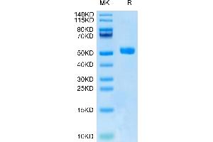 Human DKK1 N terminal Domain on Tris-Bis PAGE under reduced condition. (DKK1 Protein (AA 32-142) (Fc-Avi Tag))