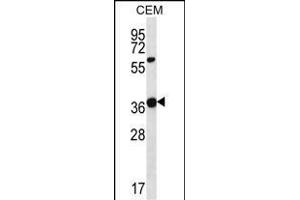 WNT16 Antibody (C-term) (ABIN657146 and ABIN2846282) western blot analysis in CEM cell line lysates (35 μg/lane). (WNT16 Antikörper  (C-Term))