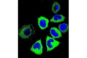 Confocal immunofluorescent analysis of Y Antibody (C-term) (ABIN655601 and ABIN2845085) with NCI- cell followed by Alexa Fluor 488-conjugated goat anti-rabbit lgG (green). (YI016 (AA 253-280), (C-Term) Antikörper)