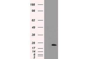 HEK293T cells were transfected with the pCMV6-ENTRY control (Left lane) or pCMV6-ENTRY TNNI3 (Right lane) cDNA for 48 hrs and lysed. (TNNI3 Antikörper)