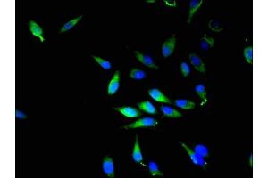 Immunofluorescence (IF) image for anti-NQO2 (NQO2) (AA 1-231) antibody (ABIN7168220)