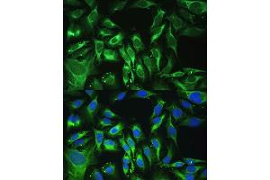 Immunofluorescence analysis of U-2 OS cells using OGN antibody (ABIN6131952, ABIN6145008, ABIN6145009 and ABIN6222384) at dilution of 1:100.