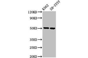 Western Blot Positive WB detected in: K562 whole cell lysate, SH-SY5Y whole cell lysate All lanes: GPA33 antibody at 3. (GPA33 Antikörper  (AA 22-235))