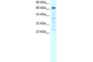 PARP3 antibody used at 1-2 ug/ml to detect target protein. (PARP3 Antikörper)