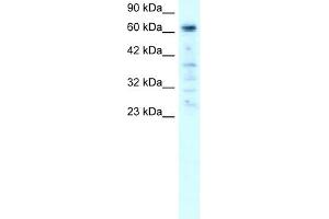 PARP3 antibody used at 1-2 ug/ml to detect target protein.