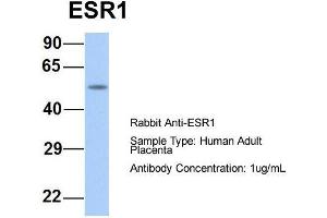 Host:  Rabbit  Target Name:  ESR1  Sample Type:  Human Adult Placenta  Antibody Dilution:  1. (Estrogen Receptor alpha Antikörper  (Middle Region))