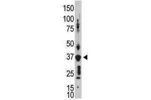 Image no. 2 for anti-Gap Junction Protein, delta 2, 36kDa (GJD2) (AA 292-321), (C-Term) antibody (ABIN357101)