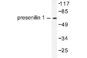 Image no. 1 for anti-Presenilin 1 (PSEN1) antibody (ABIN271789) (Presenilin 1 Antikörper)
