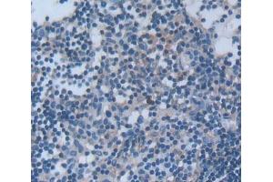 #VALUE! (Signaling Lymphocytic Activation Molecule Family, Member 2 (AA 23-217) Antikörper)
