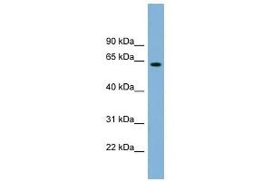 SLFN12 antibody used at 1 ug/ml to detect target protein. (SLFN12 Antikörper  (Middle Region))