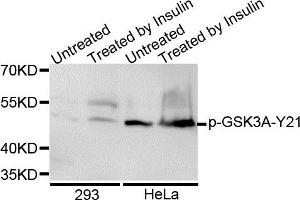 Western blot analysis of extracts of various cell lines, using Phospho-GSK3A-S21 antibody.