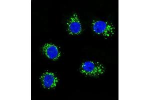 Confocal immunofluorescent analysis of MUSK Antibody (ABIN392021 and ABIN2841797) with MDA-M cell followed by Alexa Fluor 488-conjugated goat anti-rabbit lgG (green). (MUSK Antikörper)