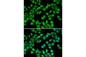 Immunofluorescence analysis of U2OS cells using MYL3 antibody (ABIN6133198, ABIN6144249, ABIN6144250 and ABIN6222363). (MYL3/CMLC1 Antikörper  (AA 1-195))