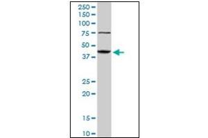 Western Blotting (WB) image for anti-Abhydrolase Domain Containing 5 (ABHD5) antibody (ABIN781986)