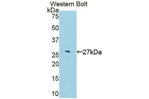Western blot analysis of the recombinant protein. (IL22RA2 Antikörper  (AA 30-228))