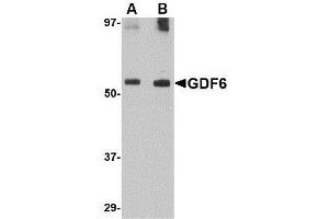Western blot analysis of GDF6 in SK-N-SH lysate with AP30360PU-N GDF6 antibody at (A) 0. (GDF6 Antikörper  (C-Term))
