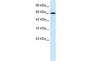 Western Blotting (WB) image for anti-Dachshund 2 (DACH2) antibody (ABIN2460463) (DACH2 Antikörper)