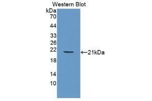 Detection of Recombinant PDGFBB, Human using Monoclonal Antibody to Platelet Derived Growth Factor BB (PDGF BB) (PDGF-BB Homodimer (AA 82-190) Antikörper)