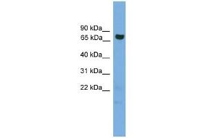 WB Suggested Anti-GCLC Antibody Titration: 0. (GCLC Antikörper  (Middle Region))