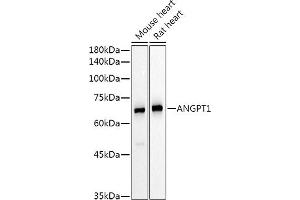 Western blot analysis of extracts of various cell lines, using  Rabbit pAb antibody (ABIN6127432, ABIN6136873, ABIN6136875 and ABIN6223859) at 1:500 dilution. (Angiopoietin 1 Antikörper  (AA 260-400))