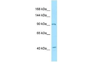 WB Suggested Anti-EPHB3 Antibody Titration: 1. (EPH Receptor B3 Antikörper  (C-Term))