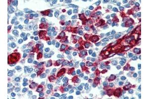 Immunohistochemistry (IHC) image for anti-Selectin P Ligand (SELPLG) antibody (ABIN614543) (SELPLG Antikörper)
