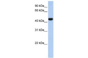 IDH1 antibody used at 1 ug/ml to detect target protein. (IDH1 Antikörper)