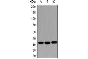 Western blot analysis of HSD17B2 expression in SW480 (A), mouse liver (B), mouse kidney (C) whole cell lysates.