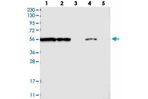 Western blot analysis of Lane 1: RT-4, Lane 2: U-251 MG, Lane 3: Human Plasma, Lane 4: Liver, Lane 5: Tonsil with FKBP9 polyclonal antibody  at 1:250-1:500 dilution. (FKBP9 Antikörper)